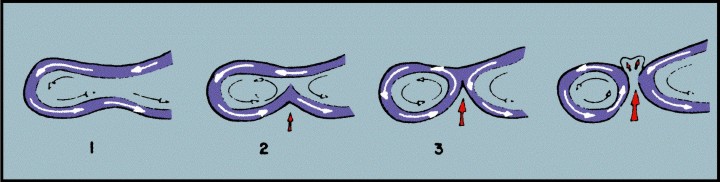 Agulhas warm core rings